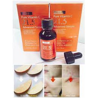 𝗦𝗲𝗿𝘂𝗺 đ𝗮̣̆𝗰 𝘁𝗿𝗶̣ 𝗺𝘂̣𝗻 𝗖𝟮𝟭.𝟱 cao cấp [ hàng chuẩn Hàn Quốc ]