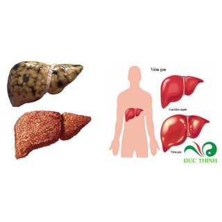  Cây mướp gai, caây móp gai