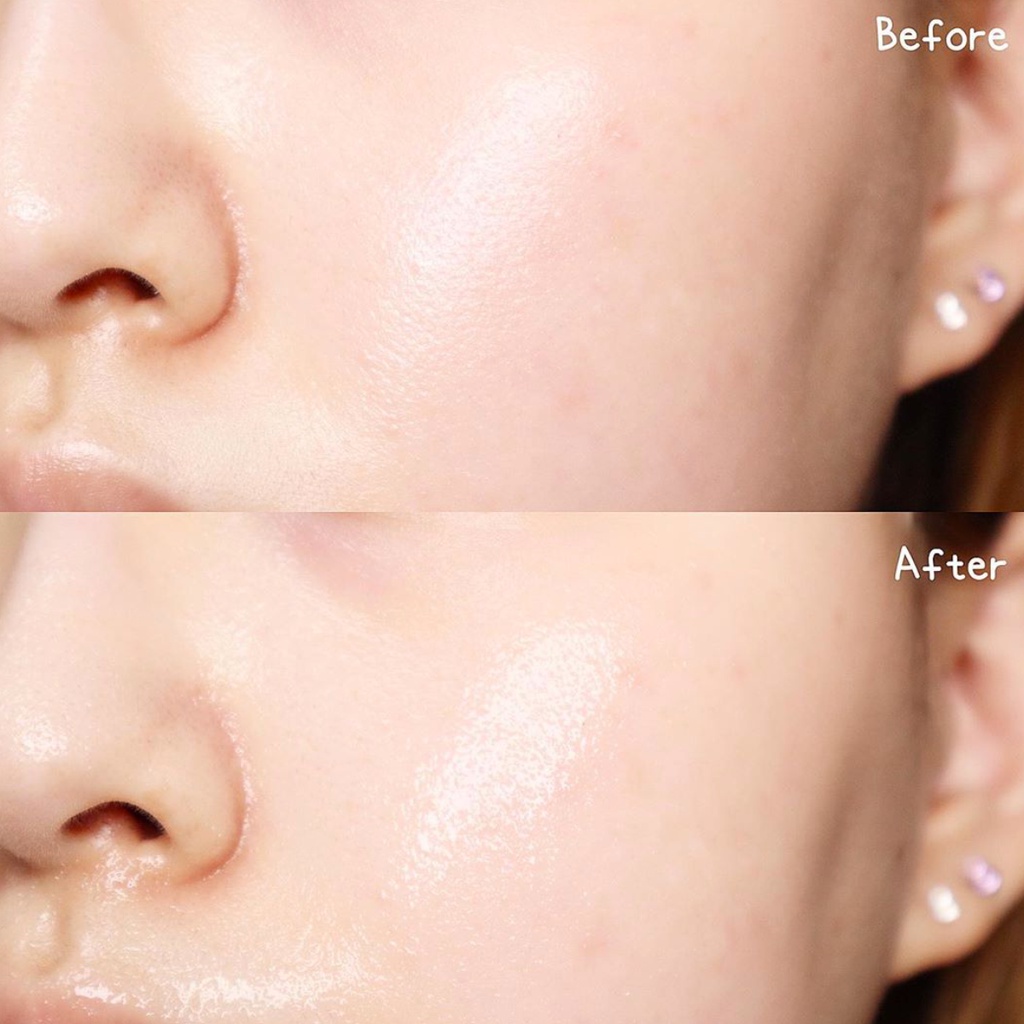Bộ sản phẩm Toner, Serum, Kem dưỡng Derladie Witch Hazel làm sạch sâu, ngừa mụn, làm đầy sẹo rỗ 3 items