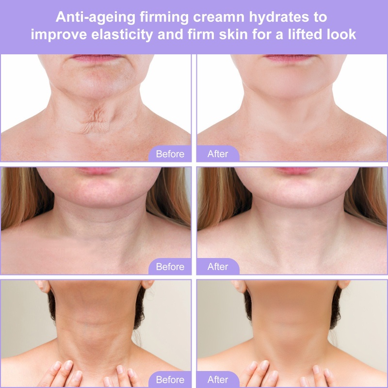 Kem Dưỡng Ẩm Nâng Cơ Làm Săn Chắc Da Mặt Và Cằm Đôi YOUYO 120ml