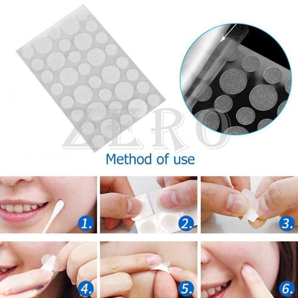 36 Cái/tờ Miếng Dán Mụn Miếng Dán Trị Mụn Axit Salicylic Miếng Dán Mặt Nạ Trị Mụn Thẻ Chăm Sóc Da Kem Dưỡng Da Mặt -pikalu