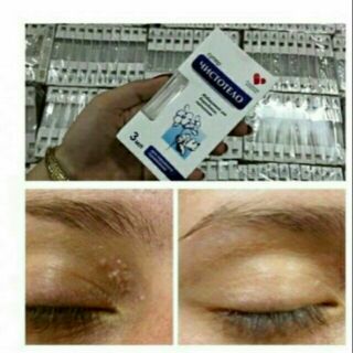 Gel chấm tẩy mụn cóc mụn thịt mụn ruồi nốt ruồi (chính hãng)-có kèm hướng dẫn