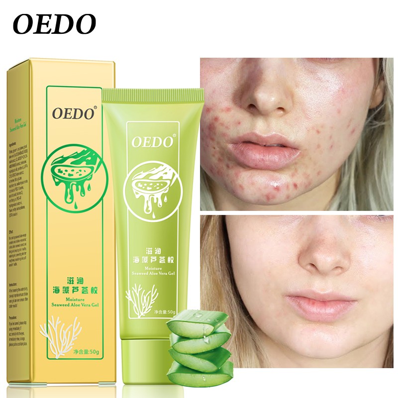 OEDO Gel lô hội rong biển dưỡng ẩm 50g