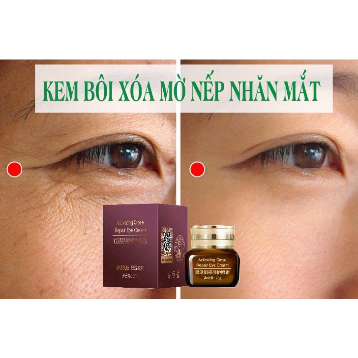 Kem bôi Giảm Thâm Mắt Xoá Mờ Nếp Nhăn DLYERN