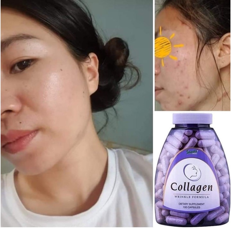 DATE 24/ Viên Collagen Wrinkle formula 150v