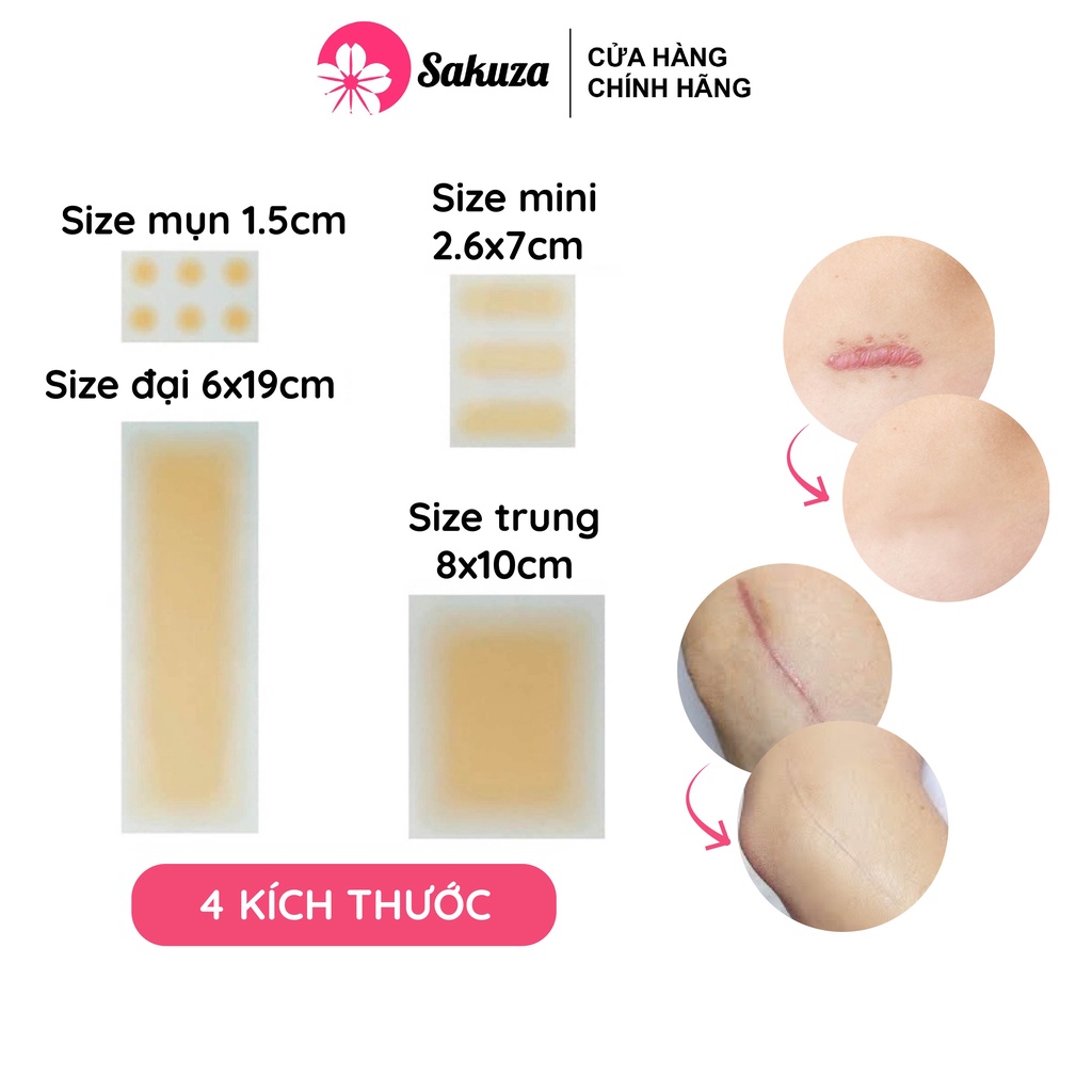  Miếng dán che sẹo lồi sẹo lõm sẹo thâm che khuyết điểm tiệp màu da Sakuza A1001 