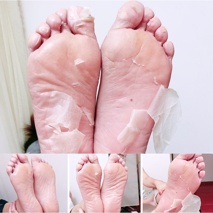 POFOOD MẶT NẠ THAY DA CHÂN PUREDERM SHINY & SOFT FOOT PEELING MASK