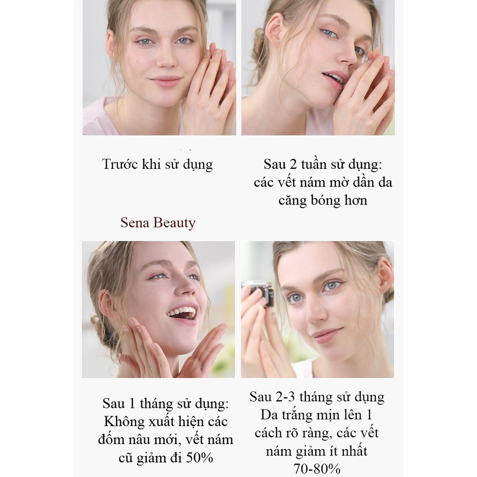 Kem dưỡng trắng da mờ nám tàn nhang Anfany Whitening Freckle Curing Cream 30G Sena Beauty | BigBuy360 - bigbuy360.vn