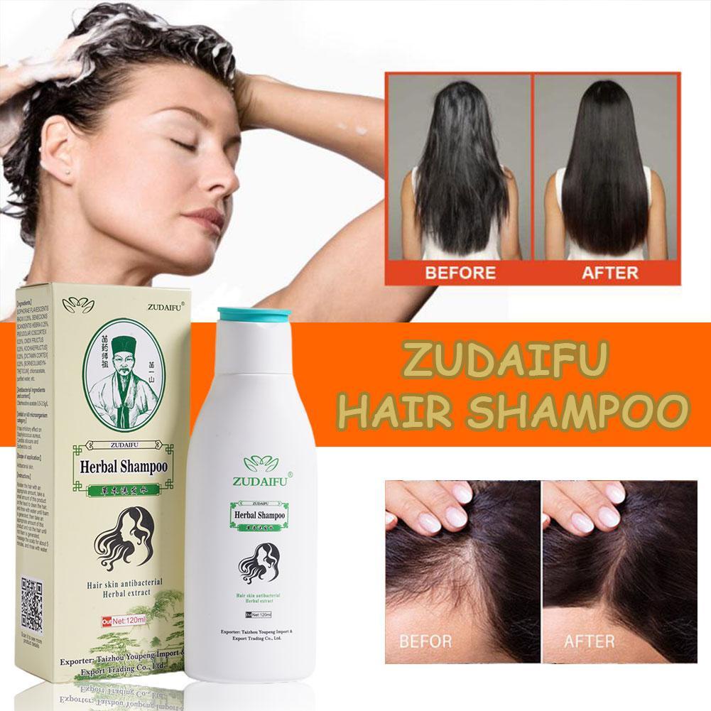 Dầu Gội Đầu Zudaifu Haar Psoriasis 120Ml Tách Biệt Keratin Doos Kruiden P0Z9