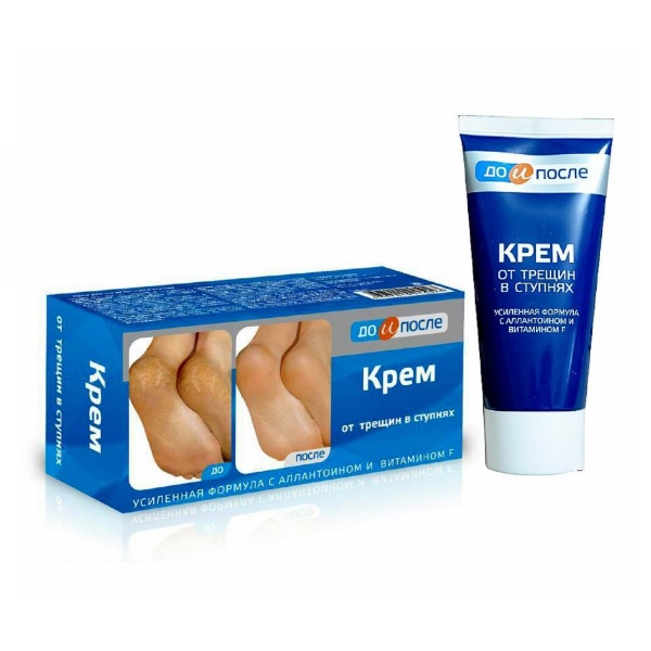 Kem Giảm Nứt Gót Chân Kpem Apteka Nga Chính Hãng 50ml