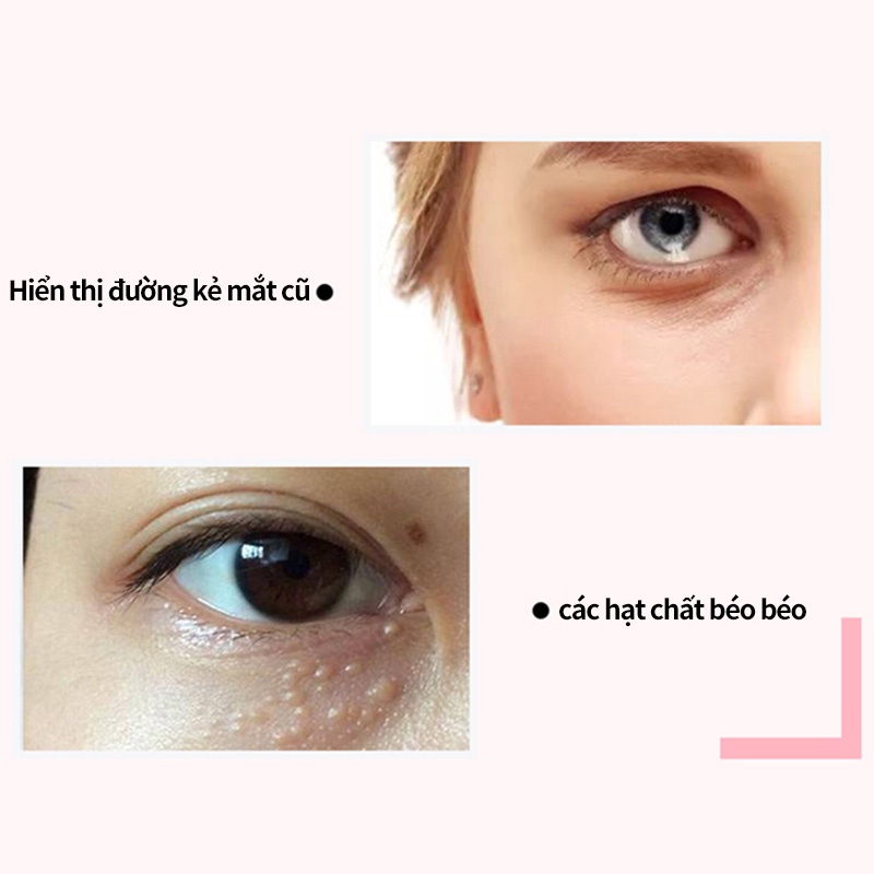 Kem dưỡng da vùng mắt ZA làm mờ nếp nhăn nâng cơ dưỡng ẩm làm săn chắc da mắt cao cấp 20g