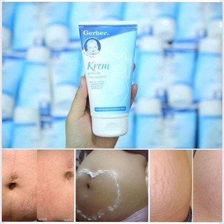 KEM TRỊ RẠN DA GERBER