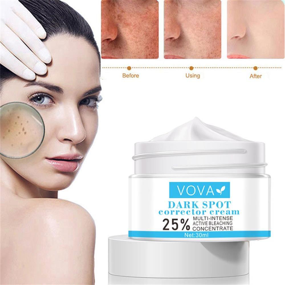 Kem Làm Trắng Da Mặt Loại Bỏ Melanin Dưỡng Ẩm Hiệu Quả