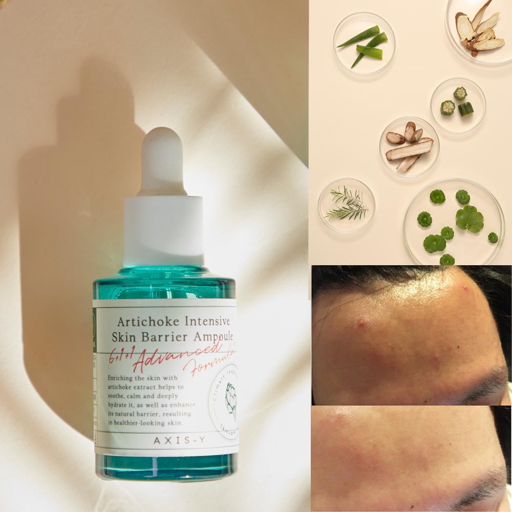 Tinh chất phục hồi da Axis-Y Artichoke Intensive Skin Barrier Ampoule 30ml
