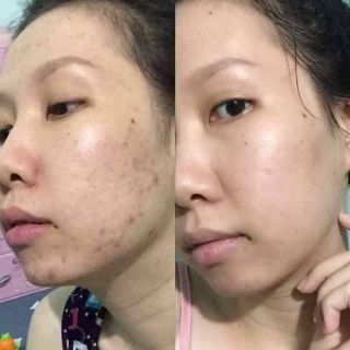 Bột Rửa Mặt