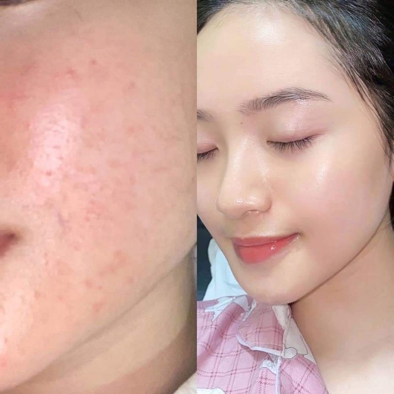 Tổng Hợp Tinh Chất Dưỡng Da Janssen