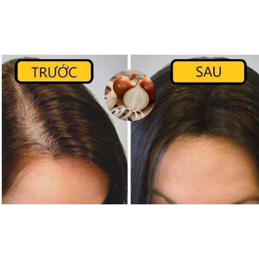 [Best Biotin] Viên Uống Hỗ Trợ Mọc Tóc Nhật Bản - 90 Viên