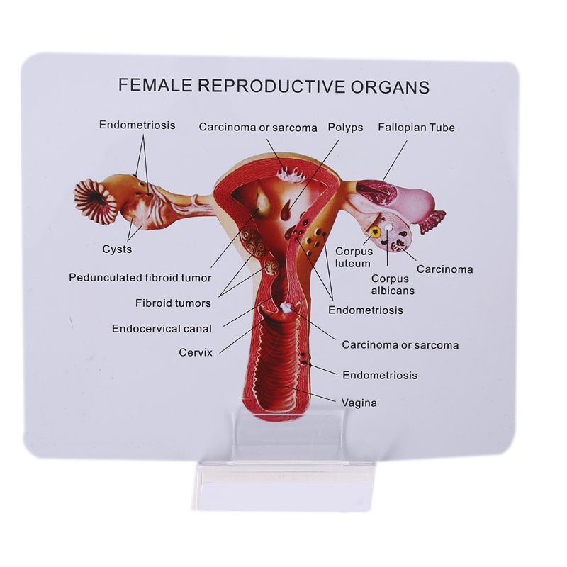 Mô Hình Lối Đi Bệnh tật Bằng Tiếng Ồn Người Phụ Nữ Uterus