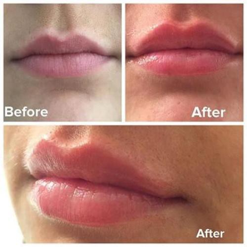 Son dưỡng cấp ẩm cho môi Image Ormedic Balancing Lip Enhancement Complex 7g