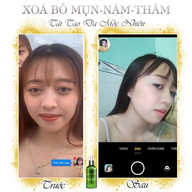 Tái tạo da mộc nhiên đông y (tặng 1 son nhung lì) | BigBuy360 - bigbuy360.vn