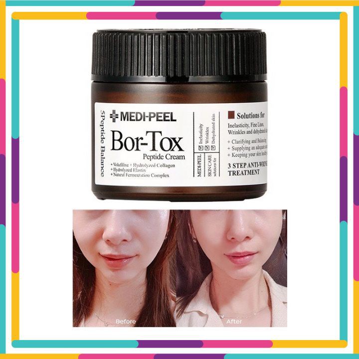 Kem Dưỡng Căng Bóng MEDI-PEEL Bor-Tox Peptide Cream Medi Peel Bortox