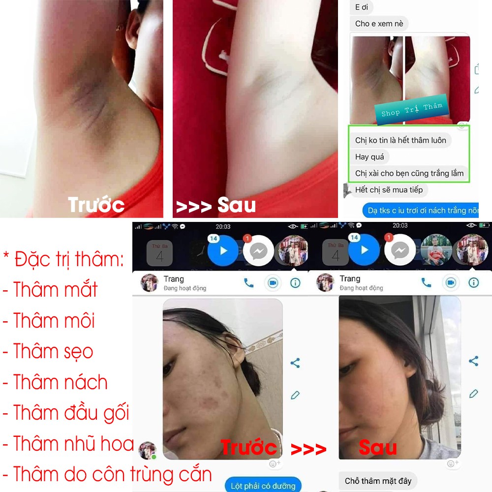 Tinh dầu Linh Hương làm mờ vết thâm da do sẹo, mụn ở mặt đầu gối, nách, nhũ hoa, côn trùng cắn 30ml | BigBuy360 - bigbuy360.vn