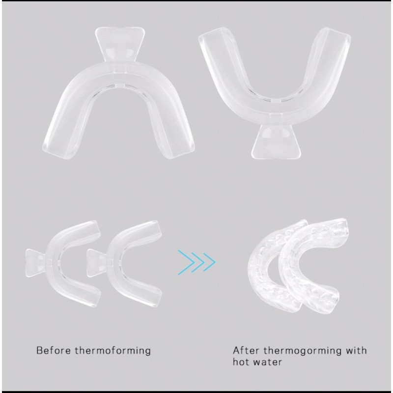 Combo tẩy trắng răng