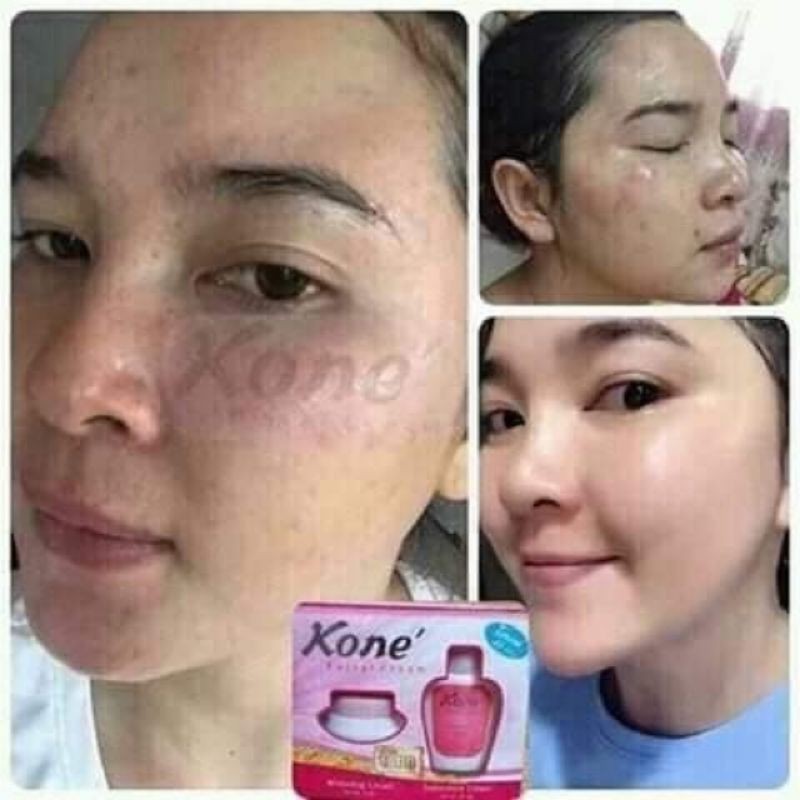 Kem kone thái lan hàng  làm trắng da mờ nám sạm