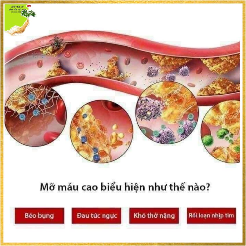 TINH DẦU THÔNG ĐỎ HÀN QUỐC - RED PINE GOLD , giúp làm sạch mạch máu, ổn định huyết áp, giảm mỡ máu, ngăn ngừa tai biến