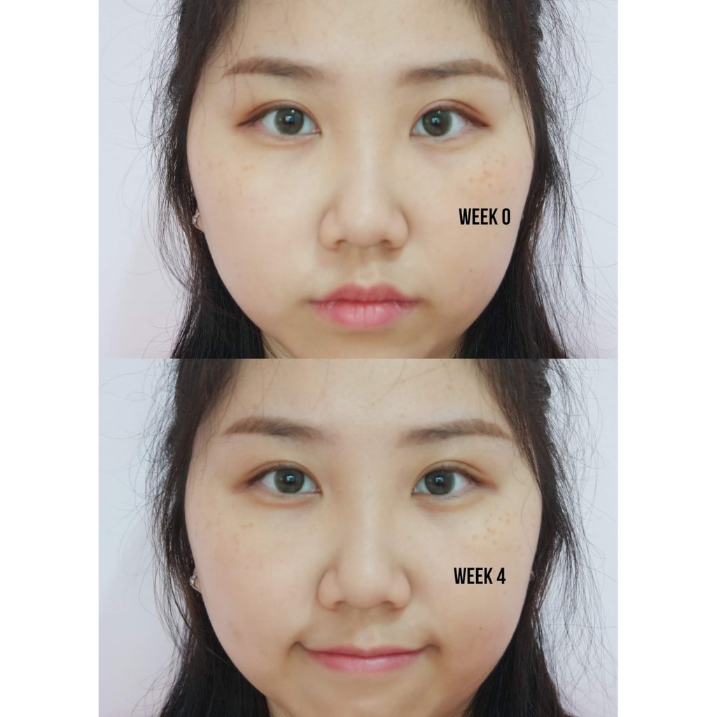 Tinh Chất Eucerin Dưỡng Làm Sáng Da, Mờ Thâm Nám UltraWHITE+ Spotless Double Booster Serum 30ml