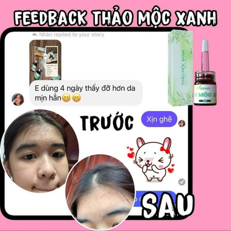 [Freeship] Thảo Mộc Xanh 5ml | BigBuy360 - bigbuy360.vn