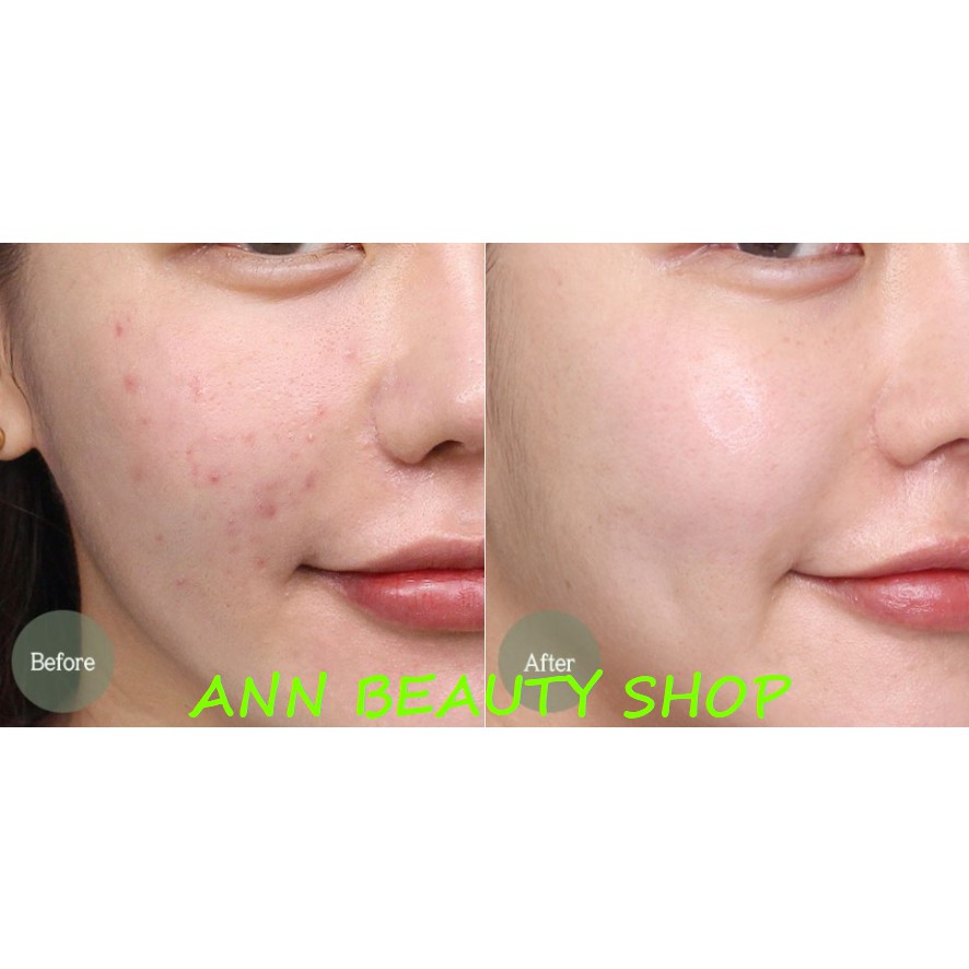 Tinh chất ngải cứu I'm From Mugwort Essence 160ml (DATE 07/2022) | BigBuy360 - bigbuy360.vn