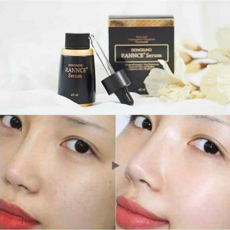 serum trị nám dongsung rannce