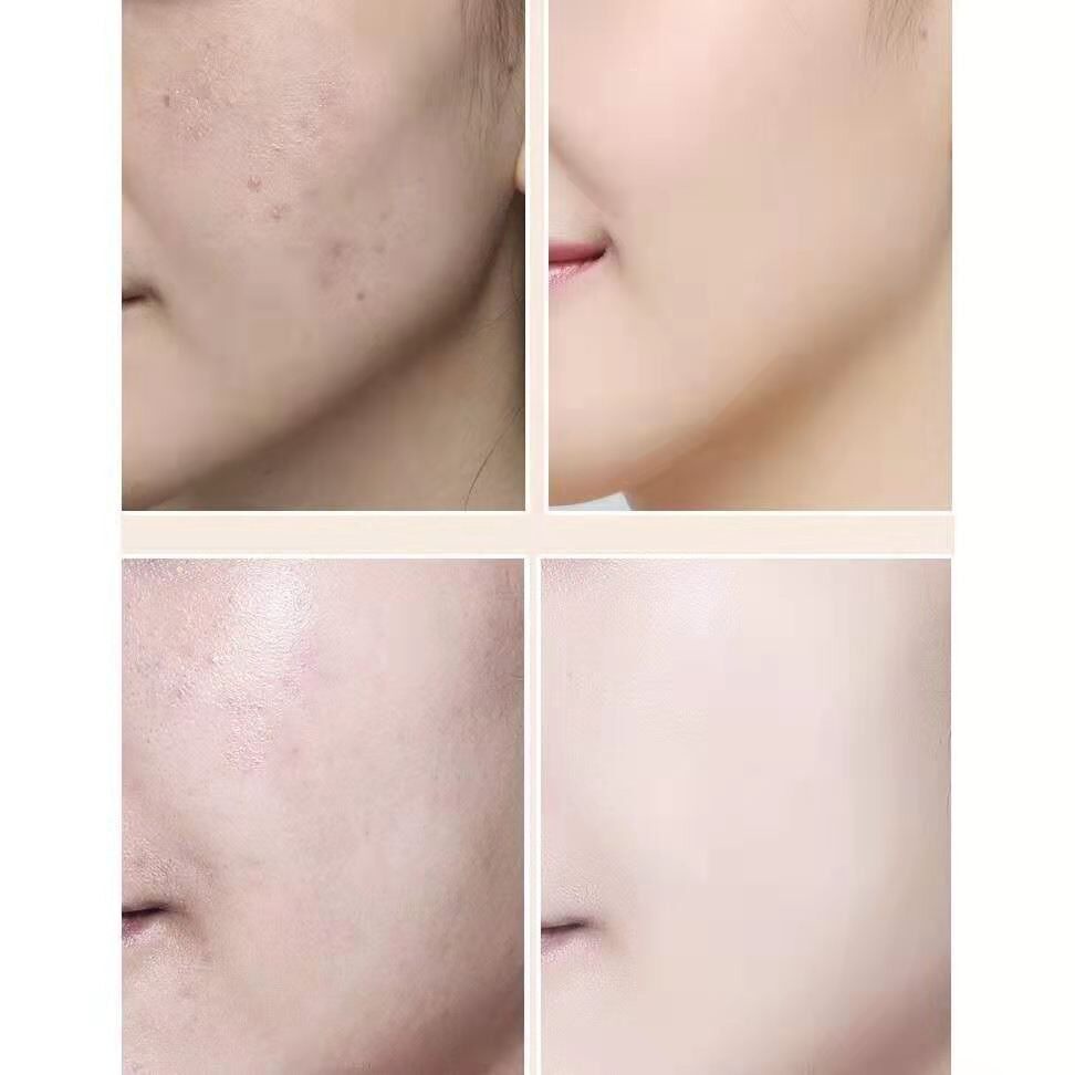 Kem Nền BB skinyo Làm Sáng Da Chống Nếp Nhăn Mụn Trứng Cá Kem BB Trang Điểm Mắt Màu Đen Tiện Dụng