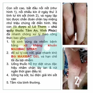 (IB lấy mã) Maxibac Spray và Maxibac gel