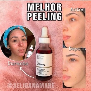 Serum tẩy da chết The Ordinary AHA 30% + BHA 2% Peeling Solution 30ml