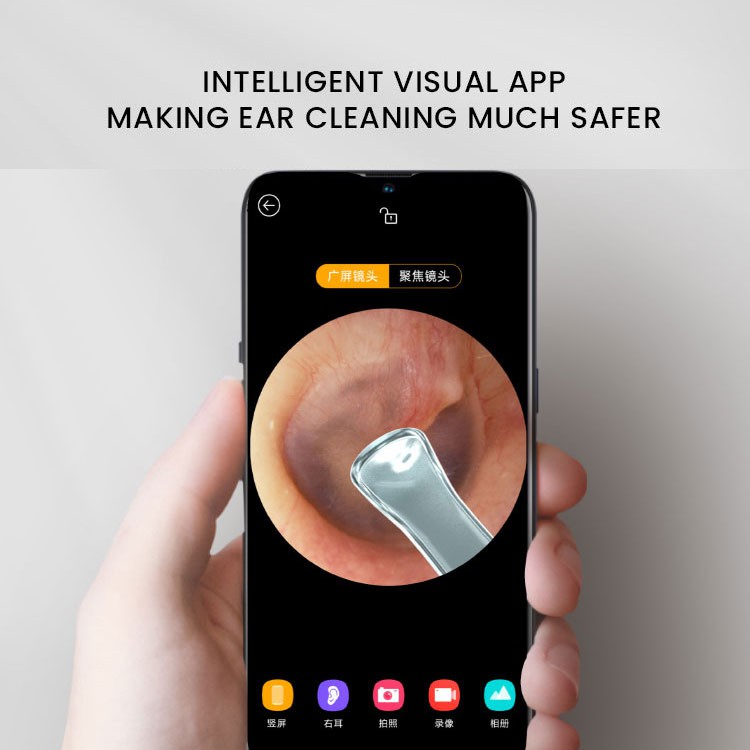 Xiaomi Youpin Thiết Bị Nội Soi Tai   Bebird R1 300w Không Dây Thiết Kế Thông Minh Độ Chính Xác Cao