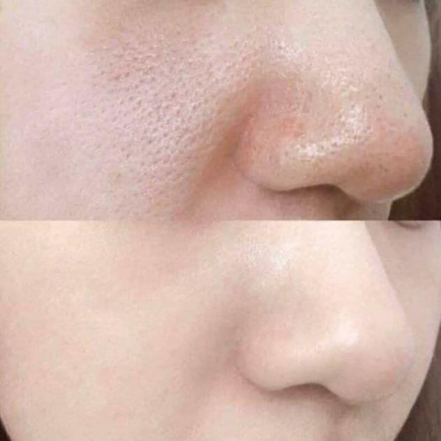 [Hàng chuẩn] Tế bào gốc POCIA 10ml se khít lỗ chân lông trong spa