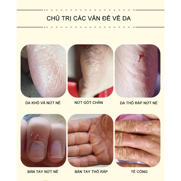 Kem Dầu Ngựa nứt gót chân, nẻ da tay chân, á sừng, bong da, dưỡng ẩm - Hàng Chất Lượng 30gr