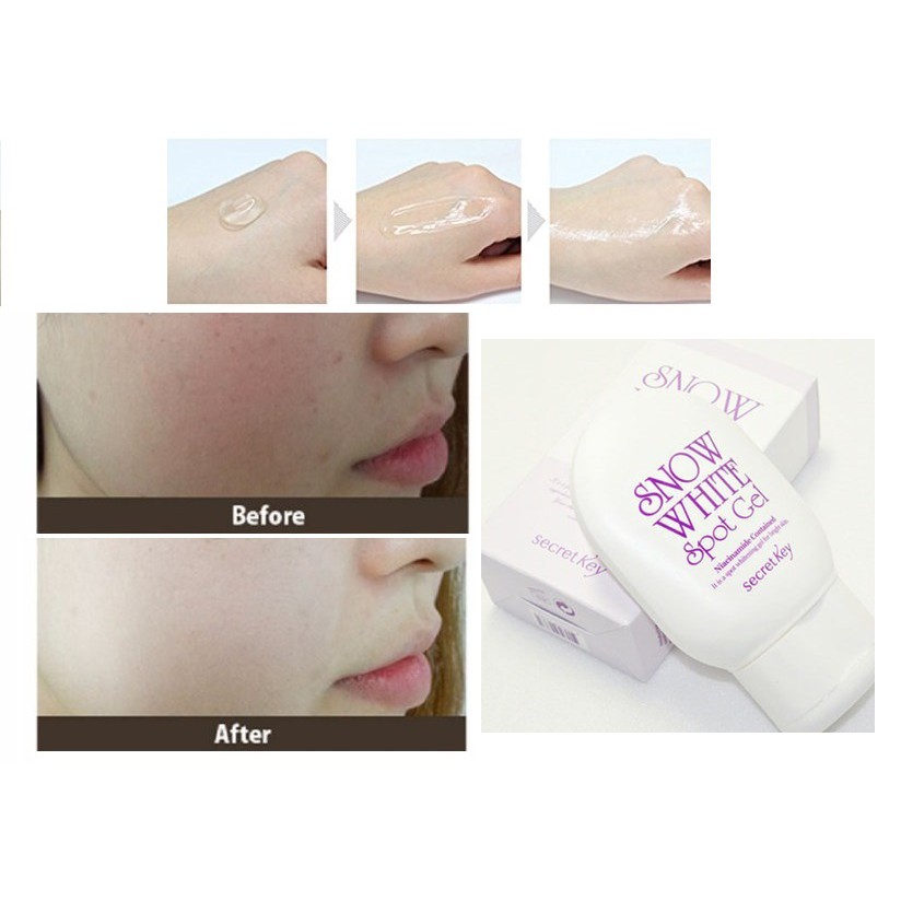 Gel giảm thâm Secret Key Snow White Spot Gel 65g