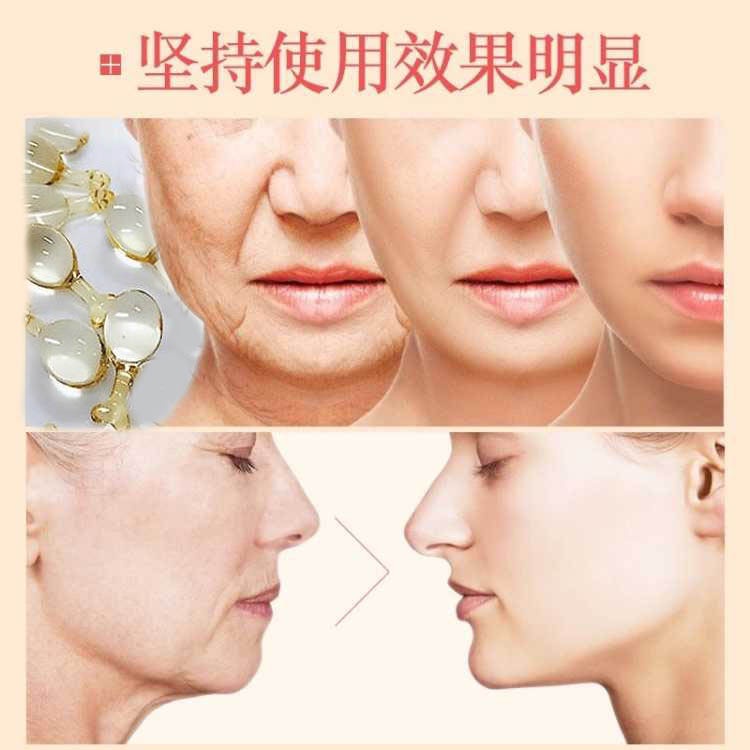 1 Tinh Chất Dưỡng Ẩm Làm Săn Chắc Da Se Khít Lỗ Chân Lông Kiểu Viên Thuốc Con Nhộng Nhỏ
