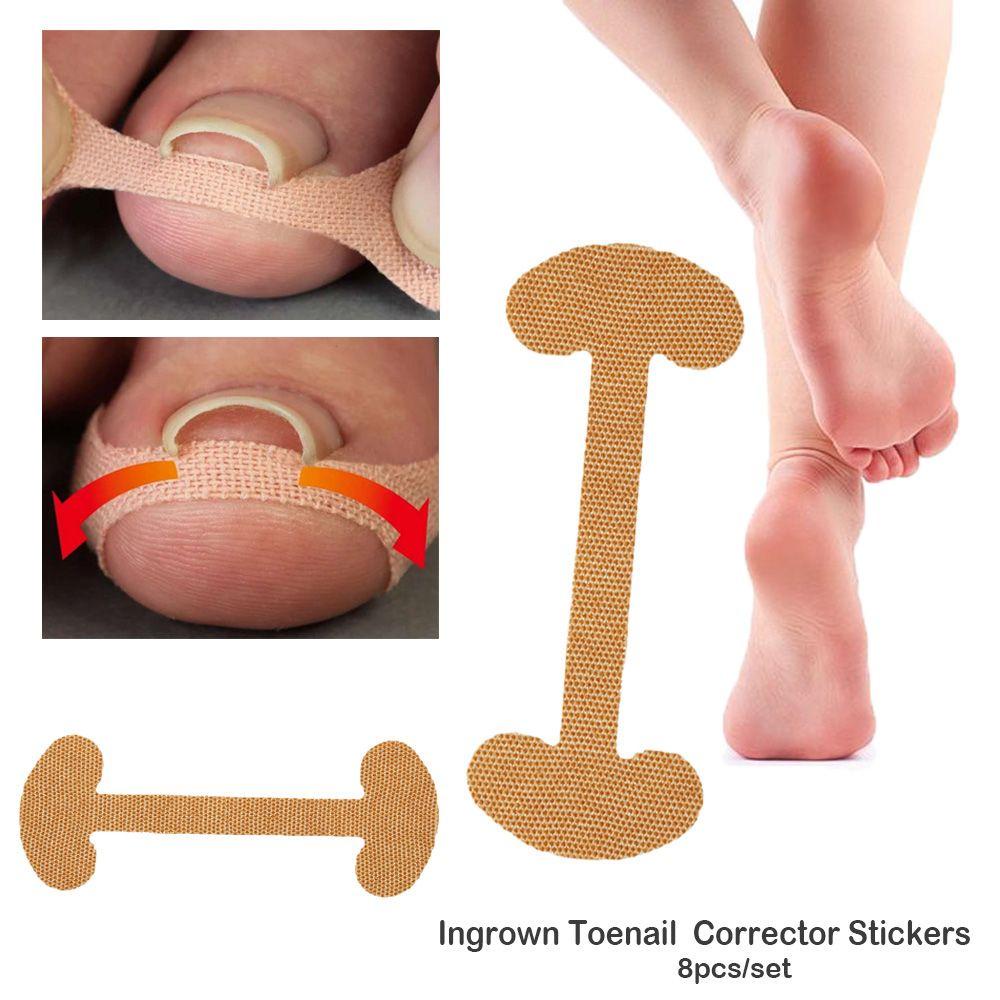 Miếng Dán Chỉnh Hình Móng Chân Chuyên Nghiệp