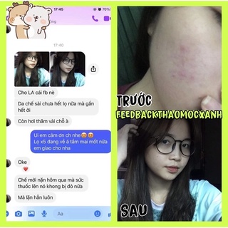 [SẴN HÀNG] SERUM THẢO MỘC XANH 3 lọ