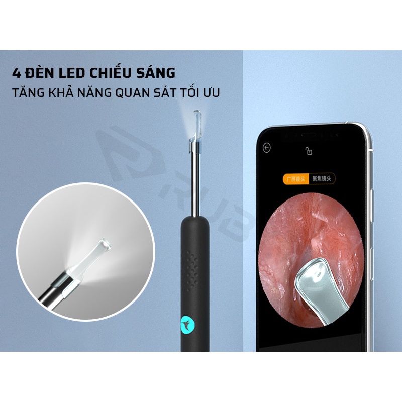 Dụng cụ lấy ráy tai tích hợp camera Bebird R1 Xiaomi chính hãng