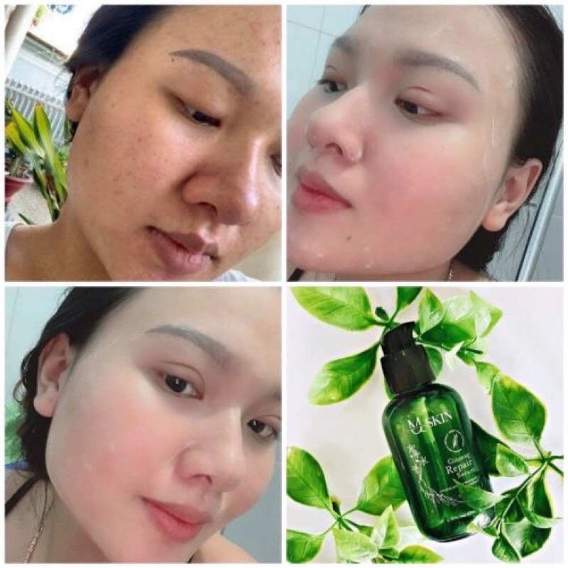 SERUM TÁI TẠO THAY DA NHÂN SÂM MẪU CŨ SỐ 1 MQ