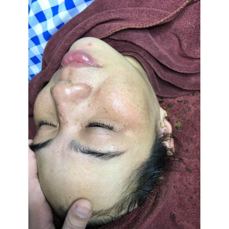 Bột Đánh Nám Tàn Nhang (gồm 2 bột và 1 lọ collagen đặc) | BigBuy360 - bigbuy360.vn