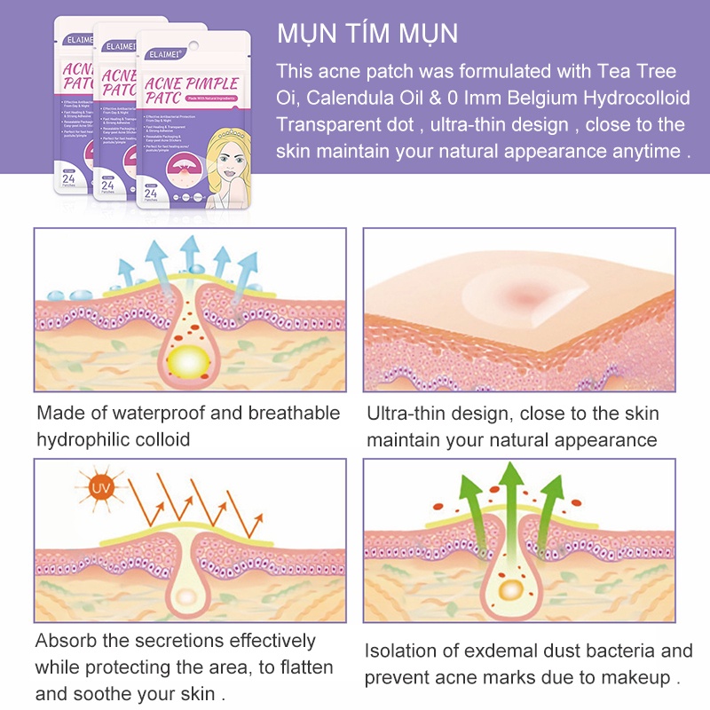 24 miếng dán mụn ẩn, làm sạch và chống viêm (LA-DDT-1)