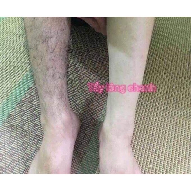  Kem tẩy lông chanh gấc Diamond Skin | BigBuy360 - bigbuy360.vn