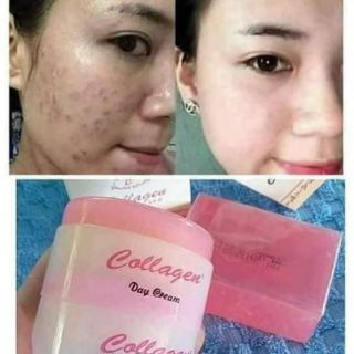 (Chính hãng) kem collagen plus vit e