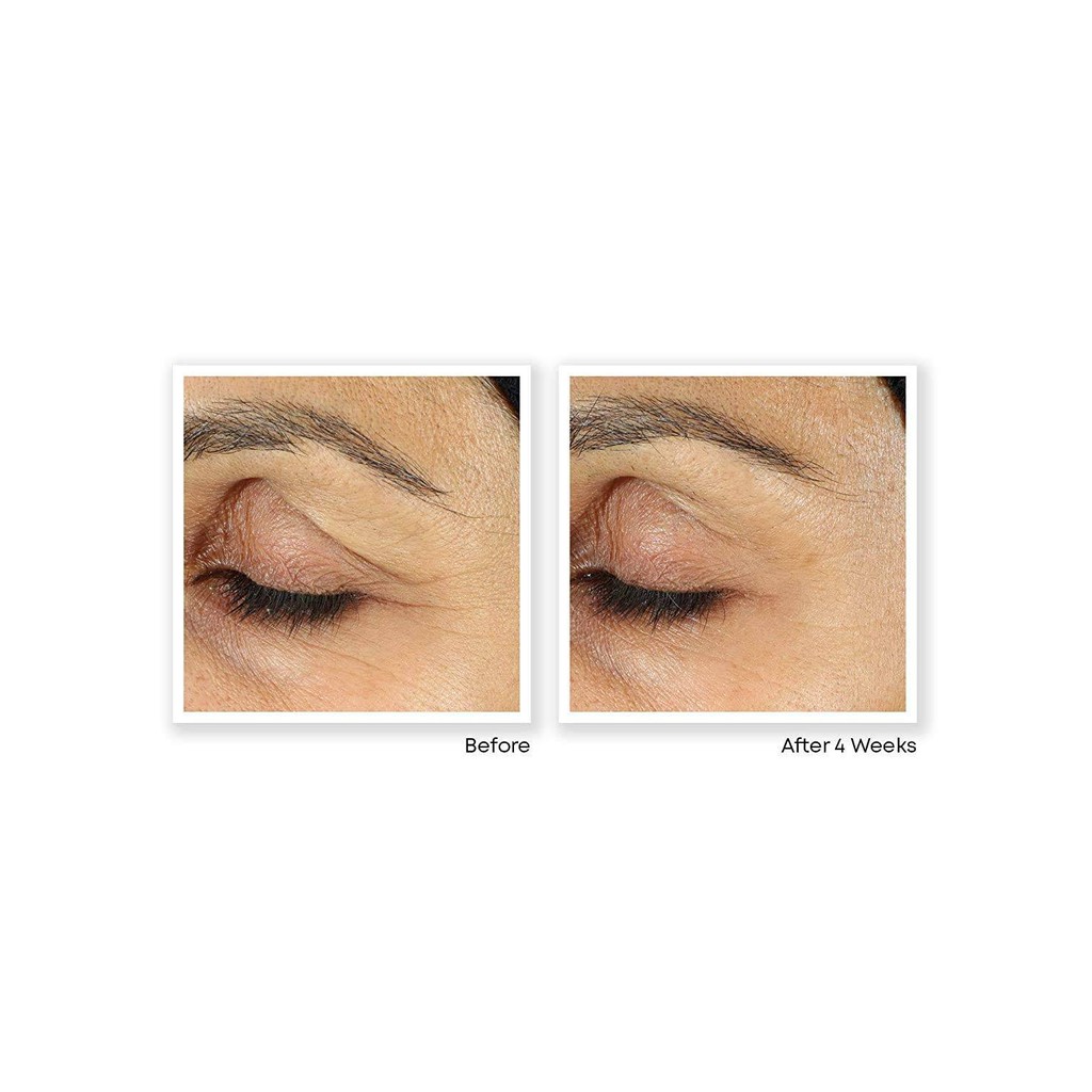 Kem mắt giảm nhăn & thâm +  Tinh chất chống lão hóa ROC Retinol Correxion | BigBuy360 - bigbuy360.vn